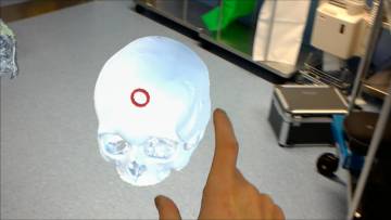 Los hologramas toman los quirófanos