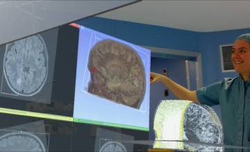 Los hologramas toman los quirófanos
