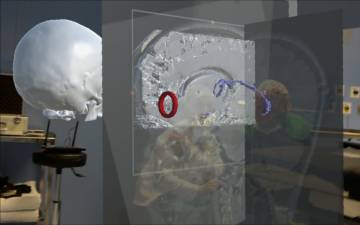 Los hologramas toman los quirófanos
