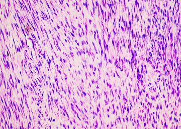 Minoryx Therapeutics: luchando contra las enfermedades raras